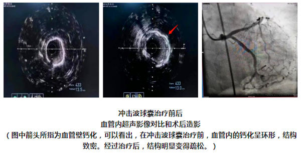 微信截图_20230913150955.jpg 微信截图_20230913150955.jpg