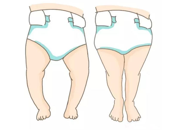 将不利于生长发育,包括影响身高,导致长短腿等